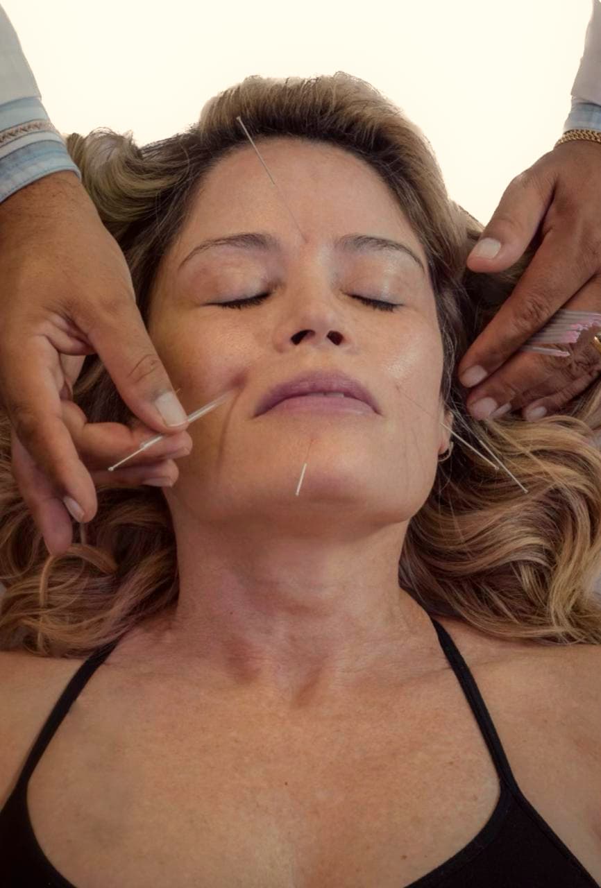 Facial rejuvenation acupuncture at My Long Life Acupuncture, North Miami